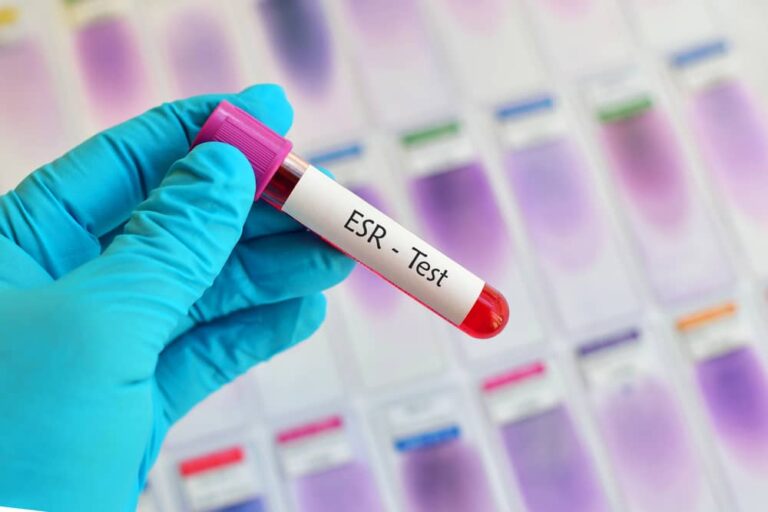 ESR-Test-In-Hindi